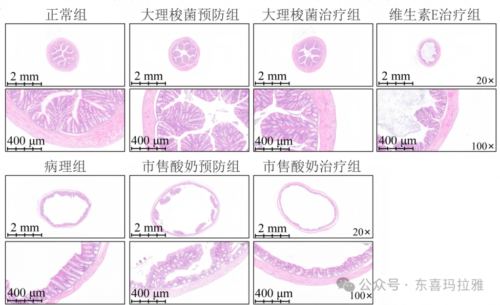 微塑料危害无处不在！别慌，我们有“解药”了！